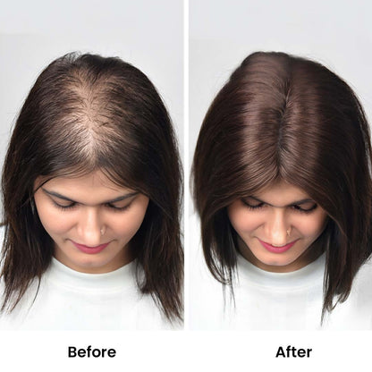 Swiss Lace Hair Topper for Women 2.6*4.5inch
