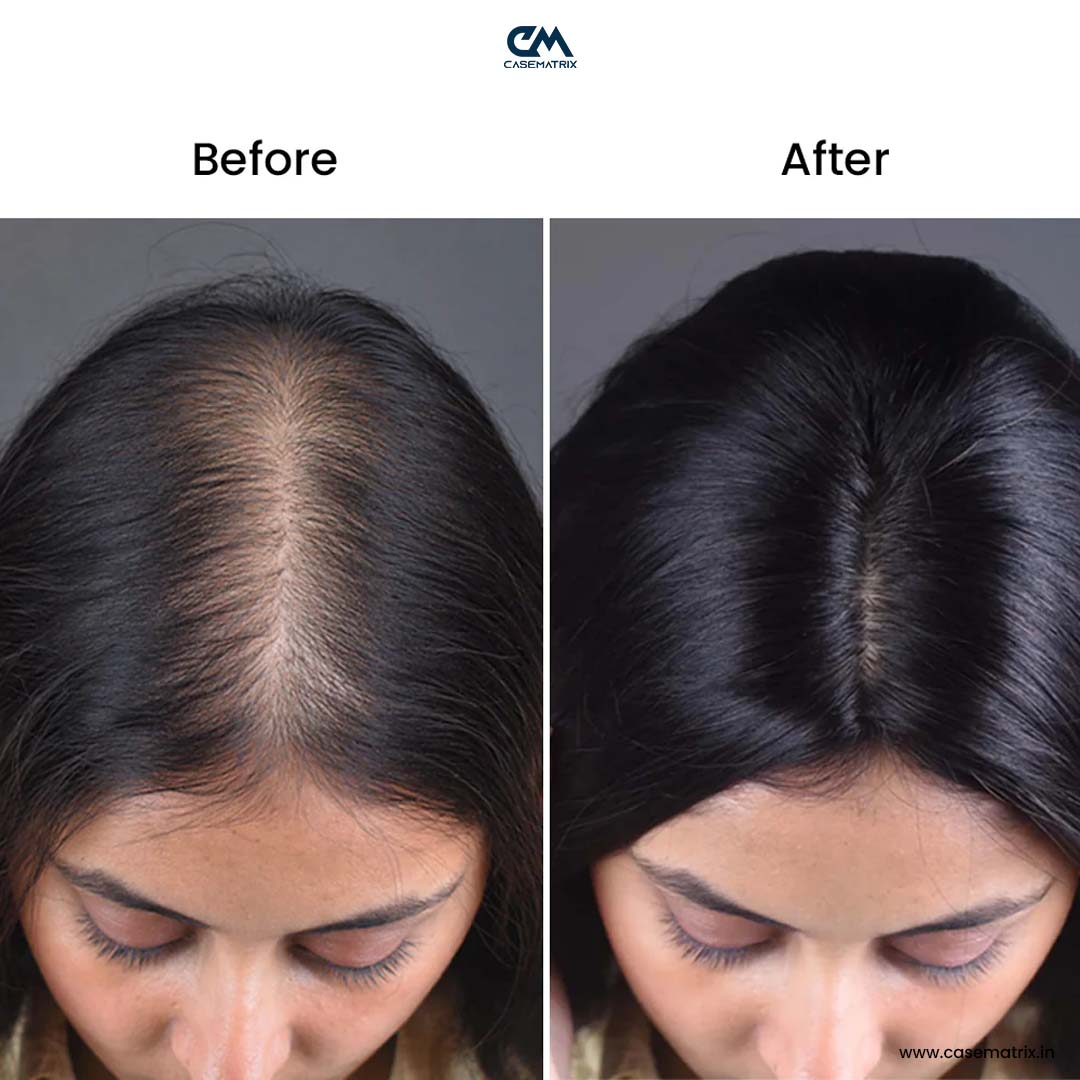 Gold-Wire Silk Base Hair Extensions 2.6*4.5Inc