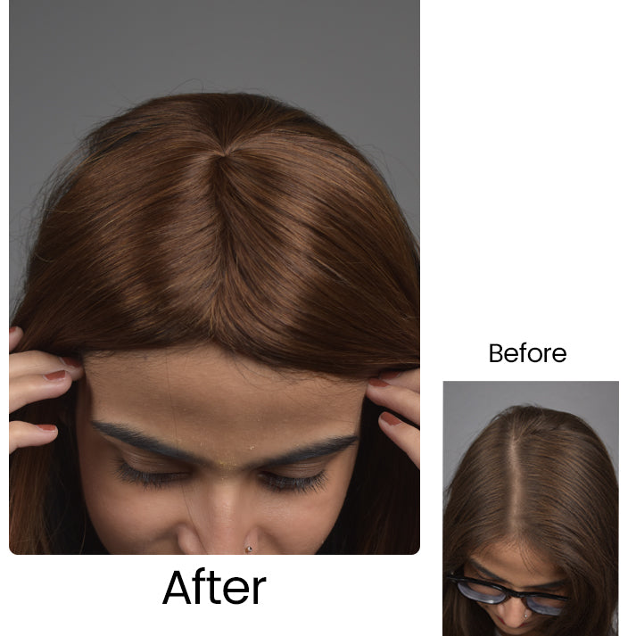 Invisible Human Hair Lace Topper - 16 Inch