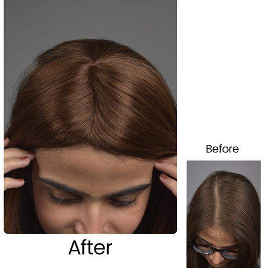 Invisible Human Hair Lace Topper - 16 Inch